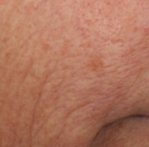 Before/After Image